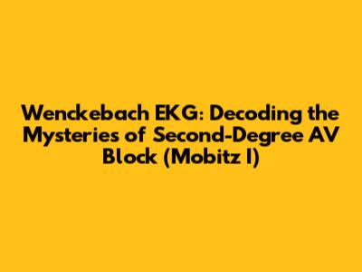 Wenckebach EKG: Decoding the Mysteries of Second-Degree AV Block (Mobitz I)